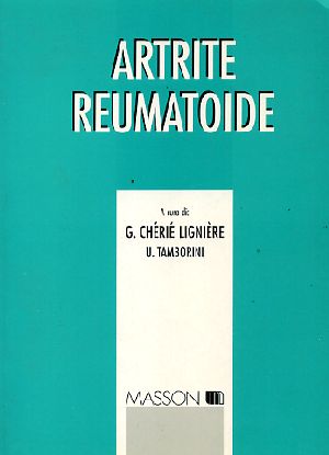 Artrite reumatoide